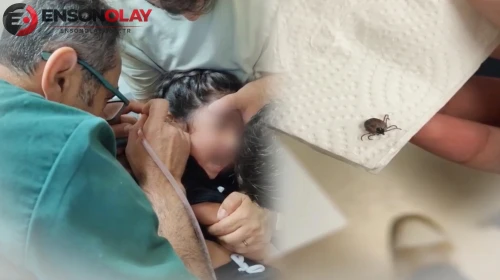 Bir aydır süren kulak ağrısının altından çıkan gerçek şoke etti! Kulağından canlı kene çıkarıldı