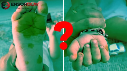 Çocuğunun el ve ayaklarını görünce korktu: Yediği şeyden olduğu ortaya çıktı