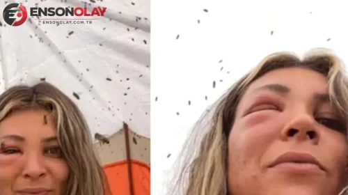 Arılarıyla yakın bağ kurmaya çalışan kadın, beklenmedik bir saldırıya uğradı
