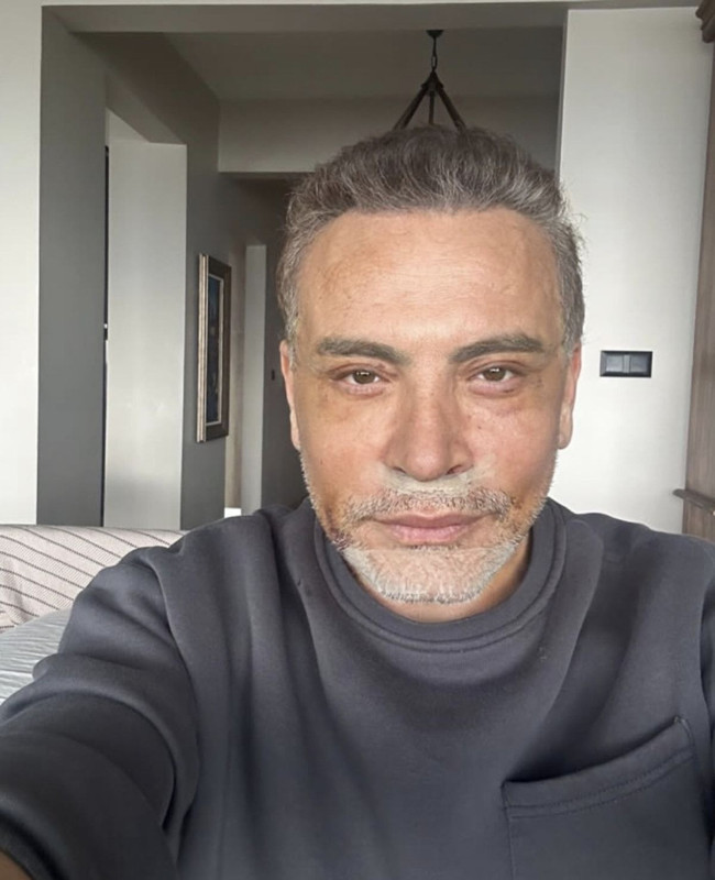 Doktorlar bile şaşırdı! Cenk Eren’in kontrolünde ortaya çıktı - Resim: 2