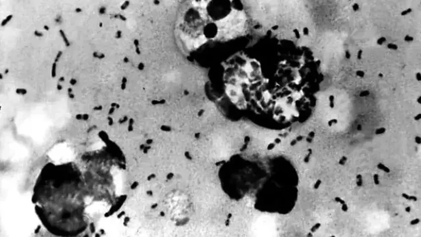Veba nasıl tedavi ediliyor?Veba, akciğer vebası da dahil olmak üzere antibiyotiklerle etkili şekilde tedavi edilebiliyor. Wagner, "Bugün büyük veba salgınlarının yaşanmamasının nedeni bu" dedi. Schaffner ise veba bakterisinin antibiyotiklere direnç kazanacak şekilde evrim geçirdiğine dair herhangi bir kanıt bulunmadığını söyledi.